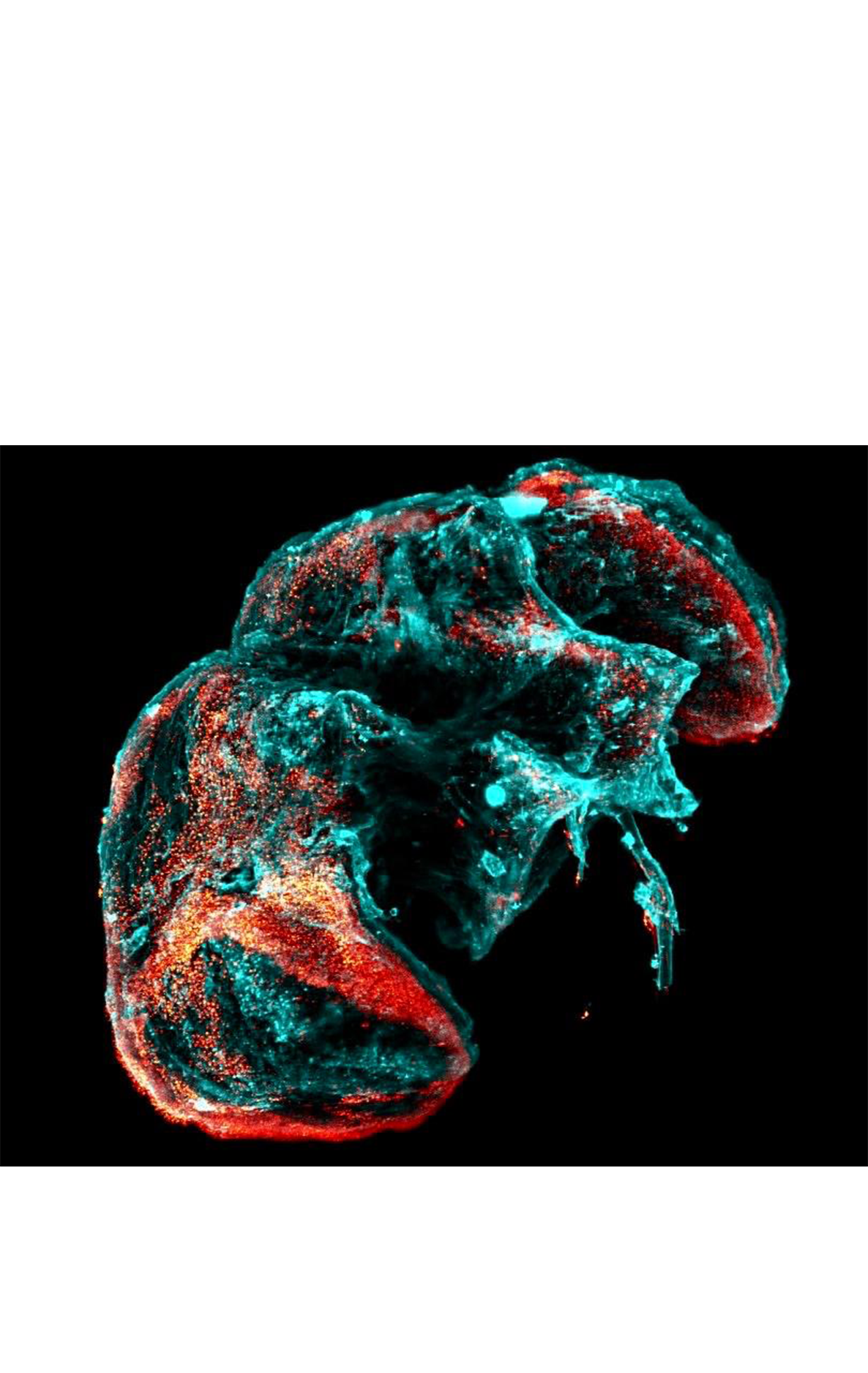 Junções neuromusculares — LSM 880